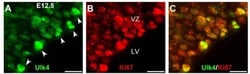 ULK4 Antibody, Novus Biologicals 0.15 mL; Unconjugated:Antibodies, Polyclonal